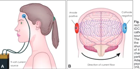 Fig. 1. Schematized transcranial di- di-rect current stimulation (tDCS). A  tDCS device uses an anode and  cathode connected to a direct current  source much like a 9 V battery (A)