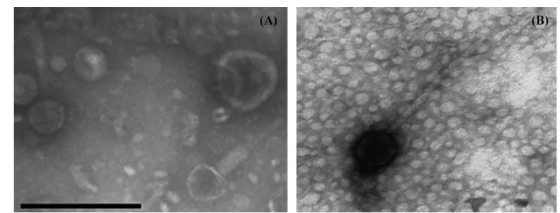Fig. 2. SDS-PAGE analysis for structural protein pattern of ES2 phage of  C. sakazakii and ST2 phage of S