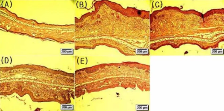 Fig. 3. Histological features of skin lesions stained with Hematoxylin &amp; eosin.  A, Negative control (non-treated); B, Positive control (DF- (DF-allergen only); C, DF+OHEM1 (1.67 mg/kg/day); D, DF+OHEM2 (16.7 mg/kg/day); E, DF+OHEM3 (167 mg/kg/day)