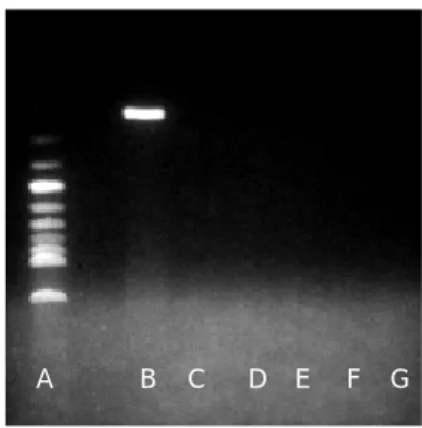 Fig. 2. Ethidium-stained 1.5% agarose gel demonstrating HPV 6/11 DNA amplimers. Lane A indicates molecular weight markers;
