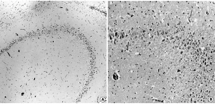 Fig. 2. Coronal section of the brain, at 8 weeks after KA injection, examined by H&amp;E stain revealed relatively intact CA2 and CA3 neu- neu-rons of the right hippocampus (A,×40), and moderate loss of CA3 neuneu-rons in the left hippocampus (B,×80)