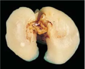 Fig. 2. Gross appearance of mouse lung with adenomas. Mouse was given a single subcutaneous injection of benzo(a)pyrene within 24 hr after birth and killed 9 weeks after birth.