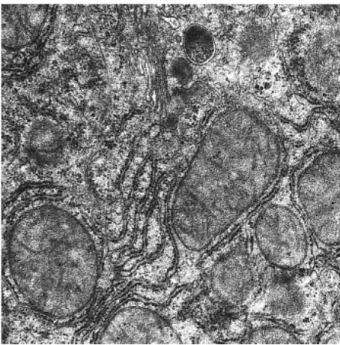 Fig. 5. -GT stain was focally weak positive in the hepatic tissue of the experimental group (×100).