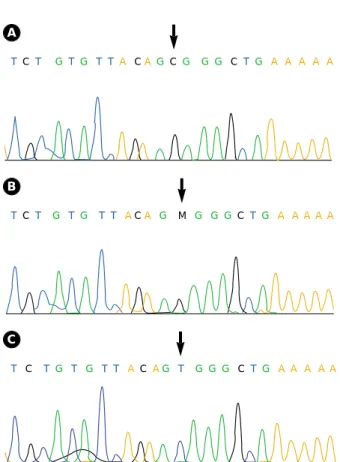 Fig. 5. Sequence analysis showing a missense mutation in the CD40L gene. A, Genomic sequence encompassing a point  muta-tion (T to C) in exon 5 of the CD40L gene from the patient; B, mother (carrier); C, father (normal control).
