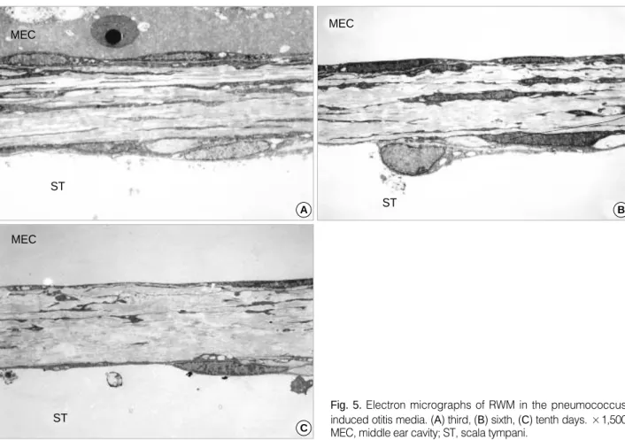Fig. 5. Electron micrographs of RWM in the pneumococcus- pneumococcus-induced otitis media