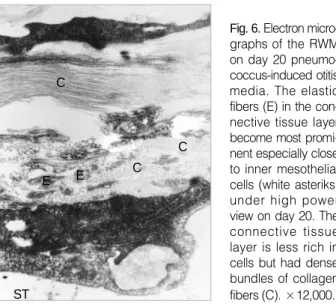 Fig. 6. Electron micro- micro-graphs of the RWM on day 20  pneumo-coccus-induced otitis media