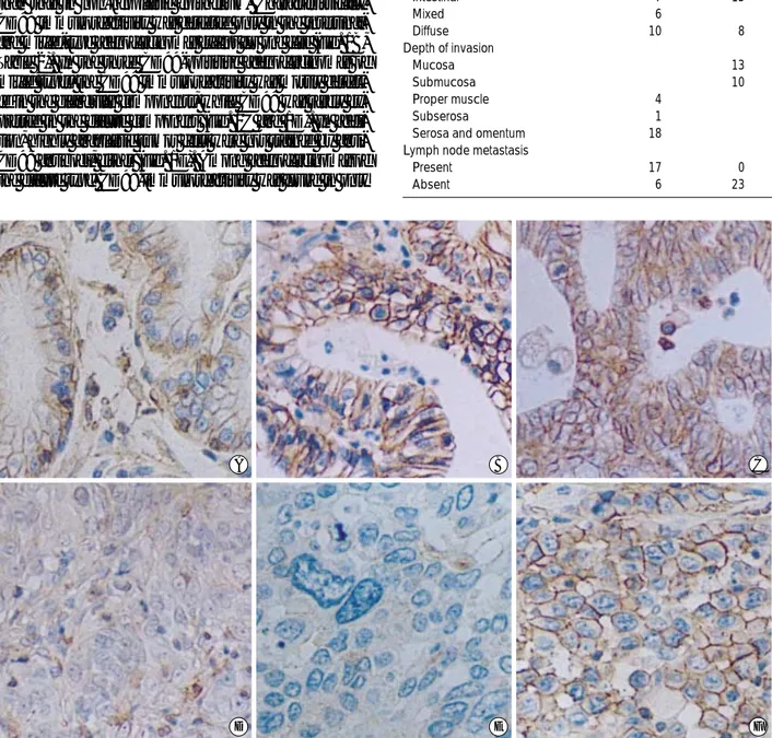 Fig. 1. Immunohistochemistry for CD99 in gastric adenocarcinoma. CD99 is expressed in the non-neoplastic gastric mucosa (A).