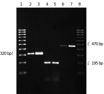 Fig. 2. RT-PCR profiles of cultured human melanocyte. RT-PCR of MCF-7 and human melanocytes yielded the predicted 195 bp PCR product for PR and 470 bp for ER at mRNA level