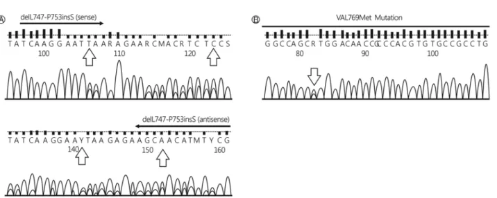 Fig. 3. Direct sequencing DNA demonstrating an exon 19 deletion (A) and an exon 20 substitution (B) in the tumor in the right lung.