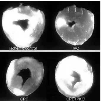 Fig. 4. Infarct size as percentage of the left ventricle. Infarct size was reduced by IPC and CPC but reduction of infarct size is  ab-olished by PKC inhibition with calphostin C (CPC+PKCi)