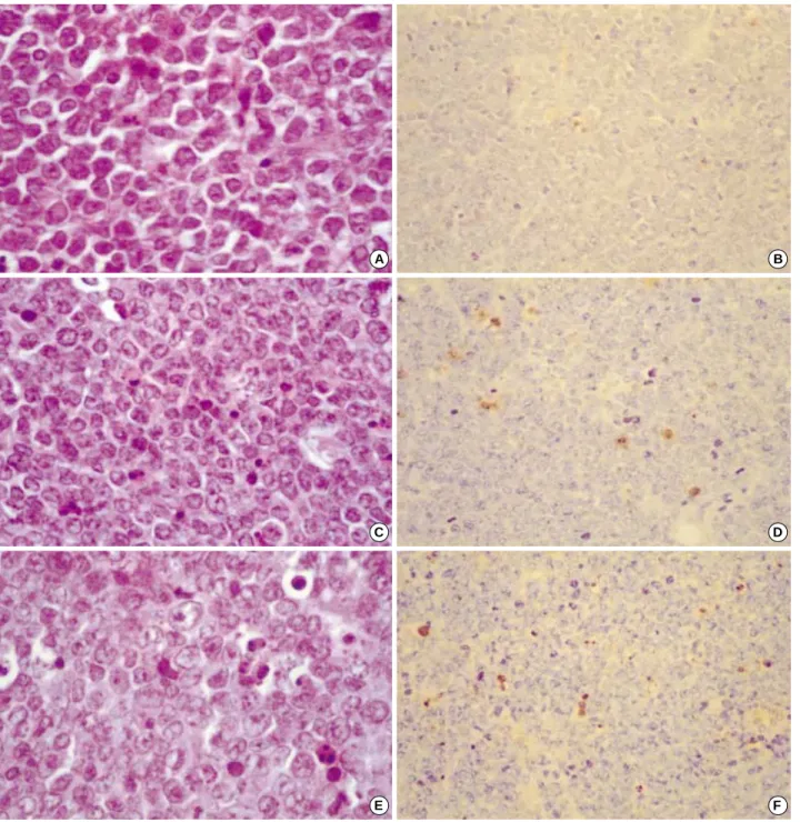 Fig. 6. Microscopic findings of A20 lymphomas treated with PBS (A, B), DC (C, D), and DC mixed with irradiated A20 cells (E, F)