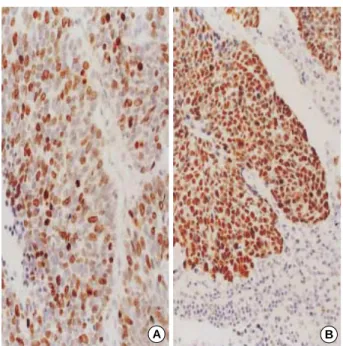 Table 4. Correlation between TTF-1 expression and p53 over- over-expression in non-small cell lung carcinomas