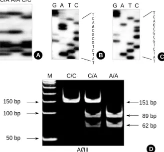 Fig. 1. Genotype analysis at -160 promoter polymorphic site of E- E-cadherin by SSCP-sequencing and RFLP