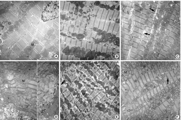 Fig. 3. Electron microscopic findings of the right ventricular wall of the sham-operated (A) or the ovariectomized (Ovx) female rats (B) treat- treat-ed with or without monocrotaline (MCT)