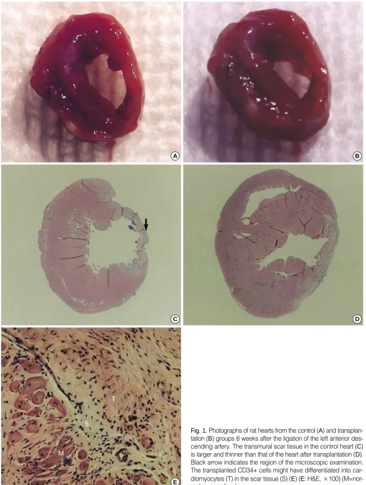 Fig. 1. Photographs of rat hearts from the control (A) and transplan- transplan-tation (B) groups 8 weeks after the ligation of the left anterior  des-cending artery