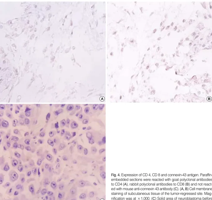 Fig. 4. Expression of CD 4, CD 8 and connexin-43 antigen. Paraffin- Paraffin-embedded sections were reacted with goat polyclonal antibodies to CD4 (A), rabbit polyclonal antibodies to CD8 (B) and not  react-ed with mouse anti-connexin 43 antibody (C)
