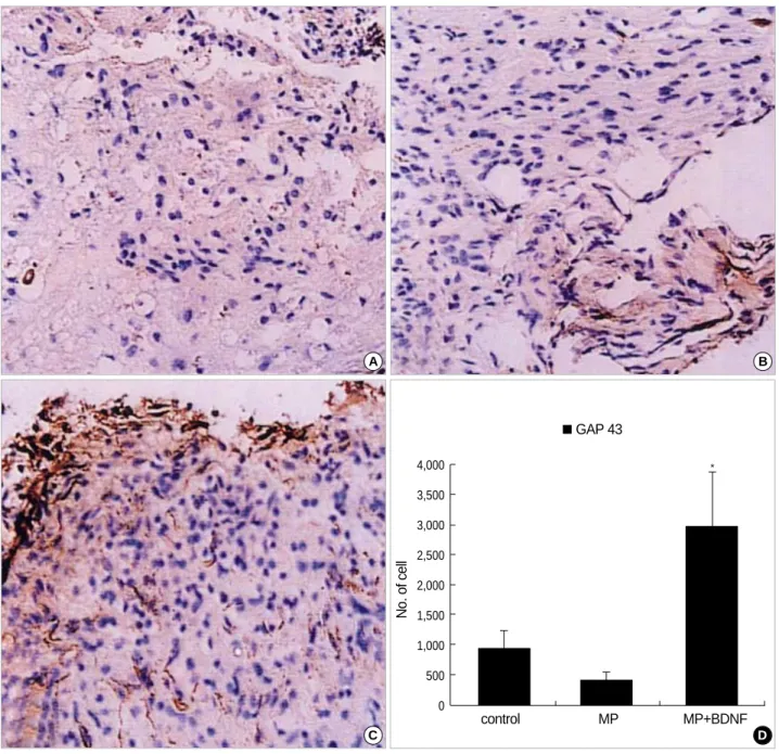Fig. 3. Immunohistochemical staining for GAP-43 at the contusion injury site (×40). Ten weeks after SCI, many GAP-43-positive neurites are found in the MP+BDNF group (C), while few are detected in the control (A) and MP-only treated (B) rats