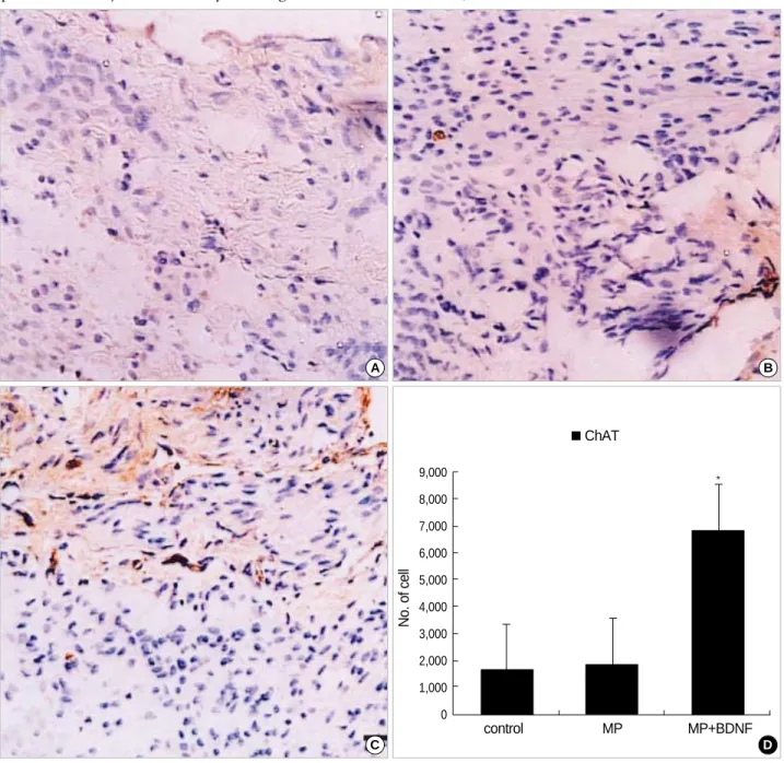 Fig. 4. Immunohistochemical staining for ChAT at the contusion injury site (×40). More ChAT-positive axons appear in MP+BDNF rats (C) ten weeks after SCI than in the other two groups (A, B)