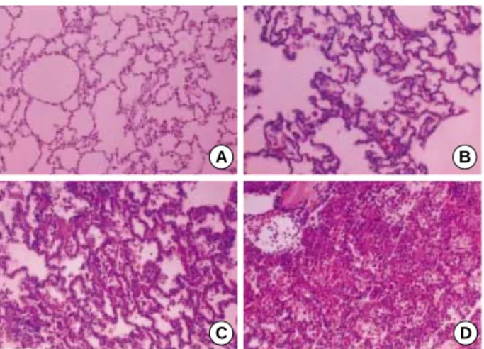 Fig. 1. Representative examples of the histologic scores (HS). (A) HS 1: normal; (B) HS 2: mild; (C) HS 3: moderate; (D) HS 4: severe.