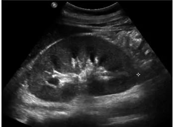 Fig. 1. Diffuse erythematous maculopapular rash is observed on