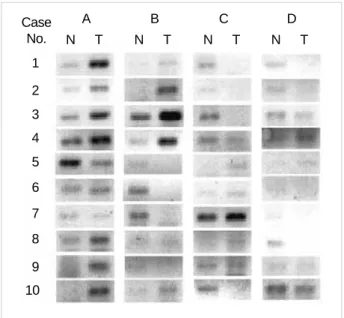 Table 3. Differential expression pattern of genes associated with -catenin regulation according to the immunohistochemical findings for  -catenin