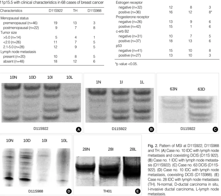 Table 4. The correlation between the frequency of MSI at chro- chro-mosome 11p15.5 and estrogen/progesterone receptor, c-erb B2 and p53 protein in 68 cases of breast cancer