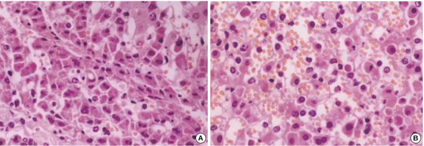 Fig. 7. Hematoxylin-eosin-stained specimens at autopsy in the ligation group (×400). The histologic features mentioned at Fig