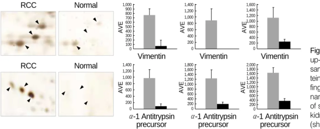 Fig. 4. The intensity of protein spots up-regulated in the conventional RCC samples. Differentially expressed  pro-tein spots identified by peptide mass fingerprinting are labeled with protein name