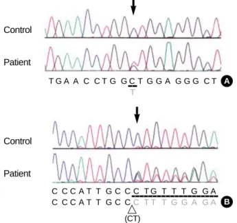 Fig. 1. Identification of SLC37A4 gene mutations. (A) Direct sequ- sequ-encing analysis demonstrated a heterozygous C to T transition (arrow; c.443C>T) resulting in a A148V missense mutation was observed in exon 3