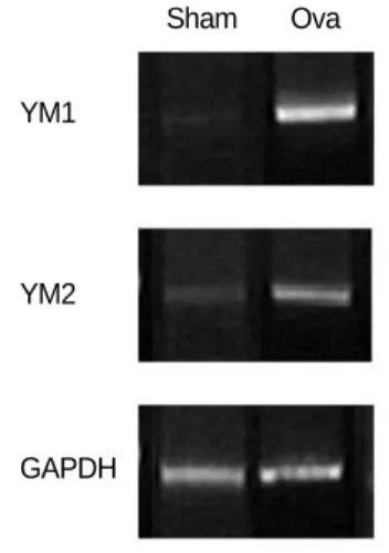 Fig. 5. RT-PCR analysis of the mRNA expression of differentially  express-ed YM proteins