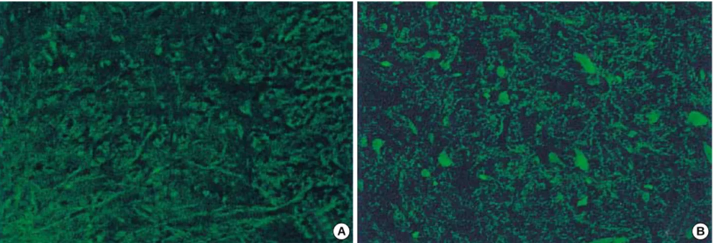 Fig. 5. Immunofluorescence of iNOS in the rat spinal cord of the control (A, ×200), and in the 72 hr group (B, ×200)
