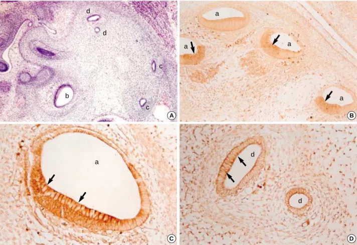 Fig. 3. Photomicrographs of hematoxylin-eosin stains (A, ×100) and immunohistochemical stains using antibodies against TGF 2 (B,