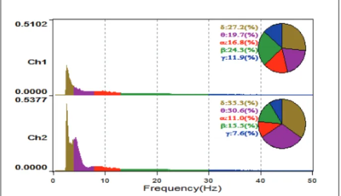 Fig. 4. Power spectral analysis of 22 groups with low intrinsic rhythm peak and amplitude (Ch1= Left prefrontal lobe, 