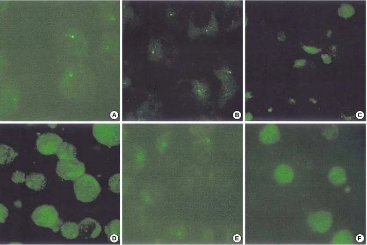 Fig. 1. The immunofluorescence pattern of endogenous IRF7 in various B lymphoblastoid cell lines