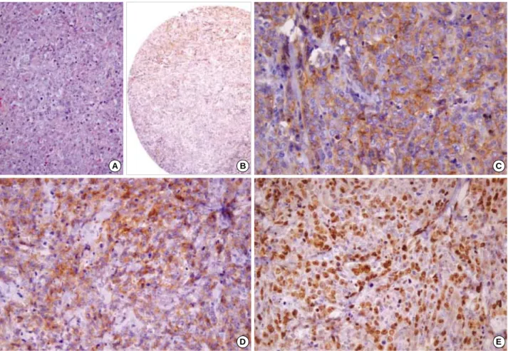 Fig. 5. Histologic and immunohistochemical findings of an 80-yr-old male CD138 positive patient (case 1)