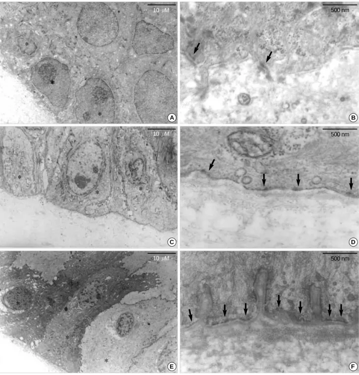 Fig. 3. EM findings of epithelial basal cells (asterisk) and hemidesmosomes (arrow) and basement membrane development