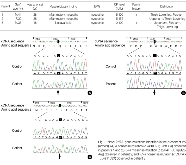 Fig. 1. Novel DYSF gene mutations identified in the present study (arrows). (A) A nonsense mutation (c.2494C>T; Gln832X) observed in patients 1 and 2; (B) a missense mutation (c.2974T>C;  Trp992-Arg) observed in patient 2; and (C) a nonsense mutation