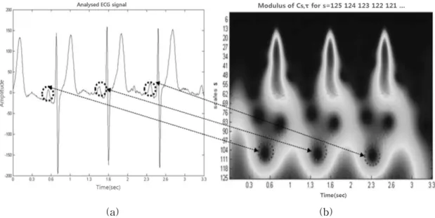 Fig. 8. Results of CWT using complex Morlet wavelet No.1-0.5 (a) signal with P-wave in first derivative from wide type electrode (b) its modulus