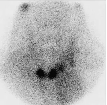 Fig. 2. Microscopic finding of the liver showing accumulation of yellow bile pigment in the hepatocytes (H&amp;E, ×400)