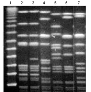 Fig. 2. Representative PFGE patterns of Sma I macrorestriction frag- frag-ments of genomic DNA of MRSA strains with low-level mupirocin resistance isolated from patients in ICUs