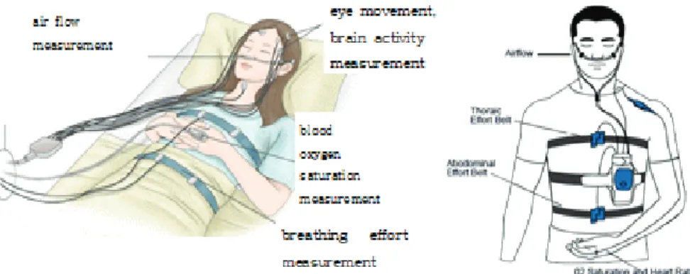 Fig. 1. Polysomnography : inpatient test (left) and mobile test device (right)