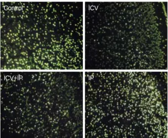 Fig. 5. Correlations of Lipid/NAA (A) and Lipid/Cr (B) ratios with morphologic scores
