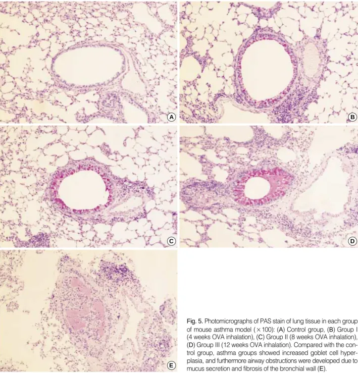 Fig. 5. Photomicrographs of PAS stain of lung tissue in each group of mouse asthma model (×100): (A) Control group, (B) Group I (4 weeks OVA inhalation), (C) Group II (8 weeks OVA inhalation), (D) Group III (12 weeks OVA inhalation)