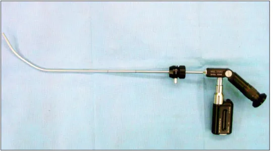 Fig.  1.  Bonfils  intubation  fibrescope.