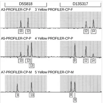 Fig. 3. Short tandem repeat analysis in the propositus (P), father (F), and mother (M) from peripheral blood DNA