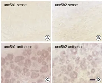 Fig. 3. unc5h mRNA expression in the adult DRG. The mRNA ex- ex-pressions of unc5h1 and 2 genes were examined by in situ  hybri-dization histochemistry