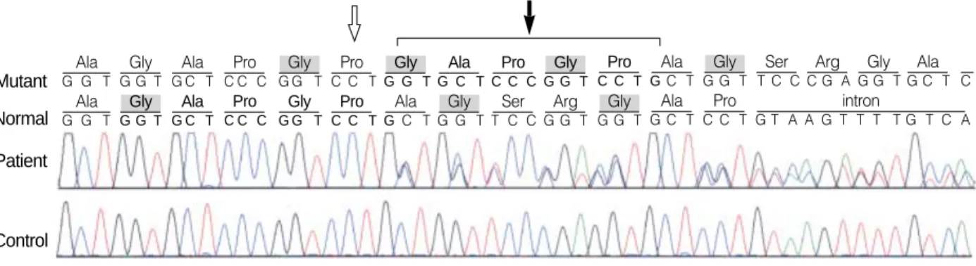 Fig. 6. Direct sequencing of the COL3A1 gene revealed a duplication of 15 base pairs (c.3221_3235dup), which results in an interposi- interposi-tion of five amino acids (p.Gly1074_Pro1078dup)