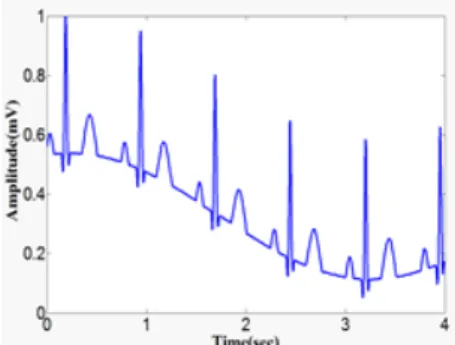 Fig. 5. Baseline wanders reduction from ECG signal  using NLMS filter 베이스  라인  드리프트는  Fig