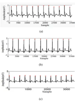 Fig. 8. R-Peak detection result using (a) 102, (b)          103and (c) 116 MIT/BIH arrhythmia data