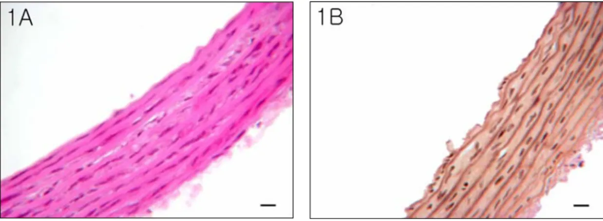 Fig. 1. Hematoxylin-eosin  staining  (1A)  and  verhoeff  elastic  fiber  staining  (1B)  in  isolated  aorta  after  removing  tunica  adventitia